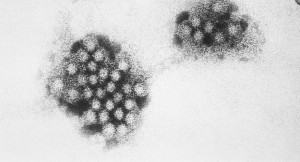 War es das hochansteckende Norovirus? Noroviren unter dem Elektronenmikroskop. Foto: Wikimedia Commons