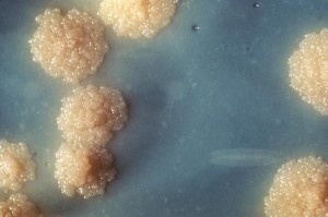 Eine Nahaufnahme einer Mycobacterium tuberculosis-Kultur. Foto: CDC/Dr. George Kubica/Wikimedia Public Domain)