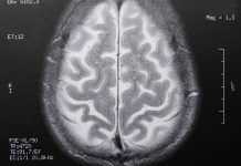 Der Intelligenzqoutient ändert sich noch länger als angenommen. (Foto: Dieter Schütz/pixelio)