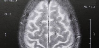 Der Intelligenzqoutient ändert sich noch länger als angenommen. (Foto: Dieter Schütz/pixelio)