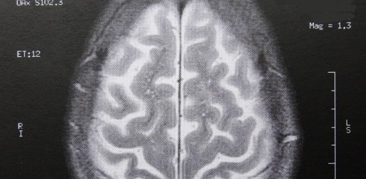 Der Intelligenzqoutient ändert sich noch länger als angenommen. (Foto: Dieter Schütz/pixelio)