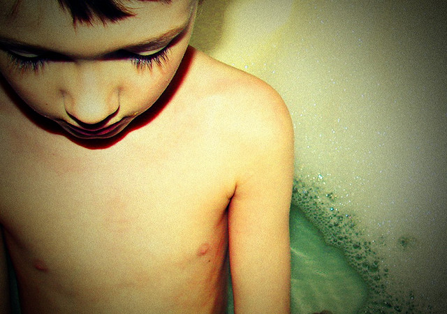 Eine unbeschwerte Kindheit? Haben viele Kinder nicht. Foto: goldsardine / Flickr (CC BY-ND 2.0) 