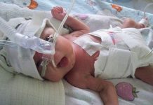 Jedes zehnte Kind ist ein “Frühchen” – das hat Konsequenzen auch für die Schulen Die Frühchen-Medizin macht große Fortschritte. Foto: Aneta Meszko / Wikimedia Commons (CC BY-SA 3.0)