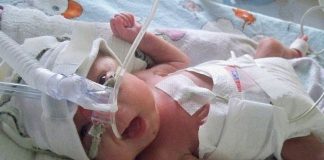 Die Frühchen-Medizin macht große Fortschritte. Foto: Aneta Meszko / Wikimedia Commons (CC BY-SA 3.0)