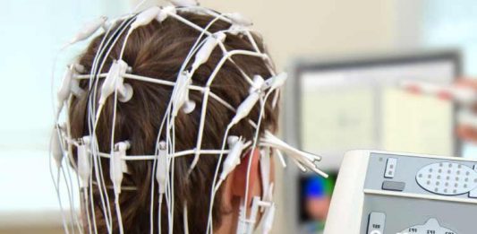 Junge mit Elektroden am Kopf von hinten, im Hintergrund Apparaturen und ein Bildschirm