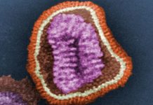 Ein Grippe-Virus unter dem Elektronenmikroskop. Foto: United States Department of Health and Human Services / Wikimedia Commons
