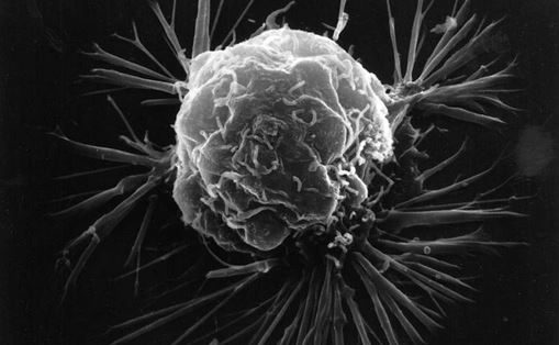 Bestimmte Bakteriengifte im Tumor können die Körperabwehr stimulieren, so dass sie den Krebs angreift. Foto: Wikimedia Commons