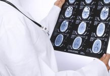 Berufsberatung mittels Hirnscan? Wissenschaftler können Neigungen bei Schülern erkennen