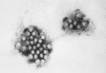 Noroviren unter dem Elektronenmikroskop. Foto: Wikimedia Commons
