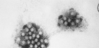 Noroviren unter dem Elektronenmikroskop. Foto: Wikimedia Commons