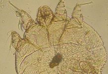 Klein und gemein: Die Sarcoptesmilbe. Foto: Kalumet / Wikimedia Commons (CC BY-SA 3.0)