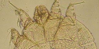 Die Rückkehr der Mini-Monster! Die Milbe, die die Krätze auslöst, ist in Deutschland auf dem Vormarsch – erste Schulen betroffen Klein und gemein: Die Sarcoptesmilbe. Foto: Kalumet / Wikimedia Commons (CC BY-SA 3.0)