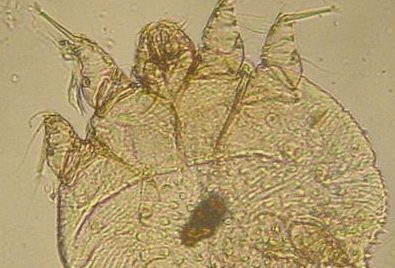 Klein und gemein: Die Sarcoptesmilbe. Foto: Kalumet / Wikimedia Commons (CC BY-SA 3.0)