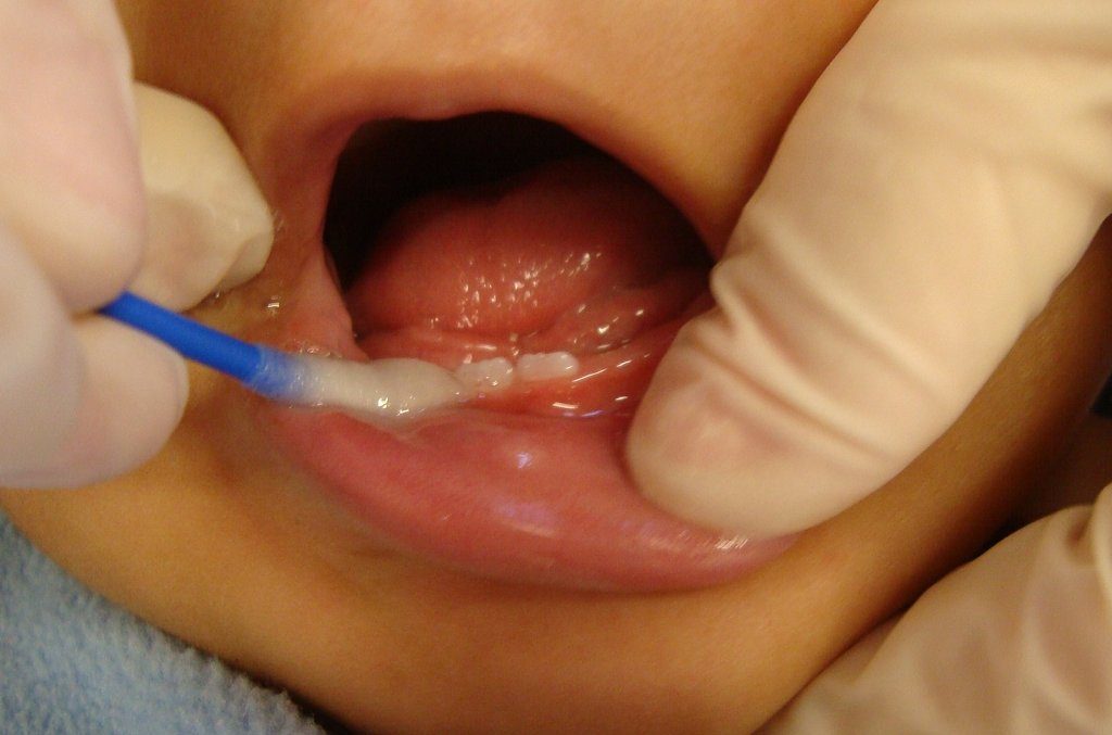 Eine LRS-Diagnose per Speichelprobe könnte vielen Schülern einen Leidenweg ersparen und bietet geschäftliche Möglichkeiten. Odontoped-Ata / Wikimedia Commons (CC BY-SA 3.0)