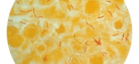 Mikroskopische Ansicht von Tuberkulose-Bakterien