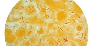 Mikroskopische Ansicht von Tuberkulose-Bakterien