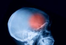 Grundschüler stirbt an Meningokokken-Infektion – Kontaktpersonen in Behandlung