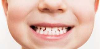 Landesamt stellt fest: Immer mehr Kinder haben gesunde Zähne